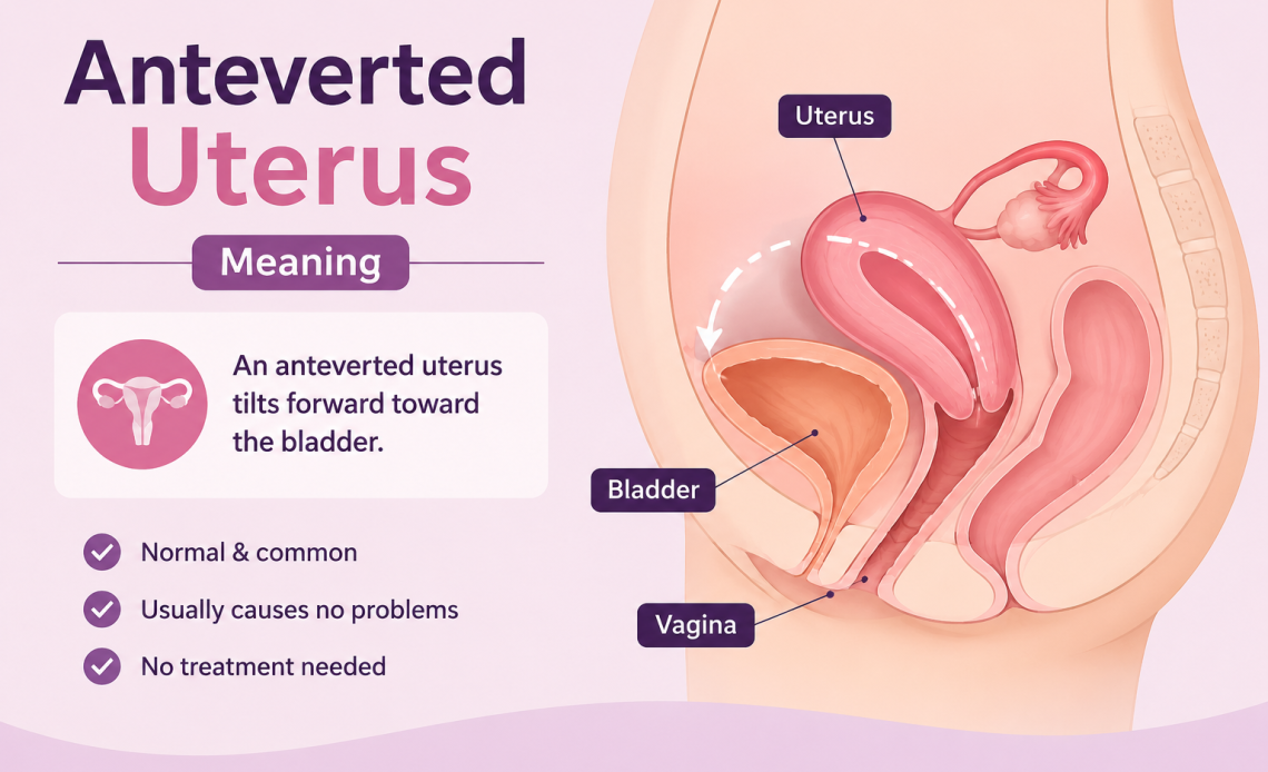 Anteverted uterus meaning